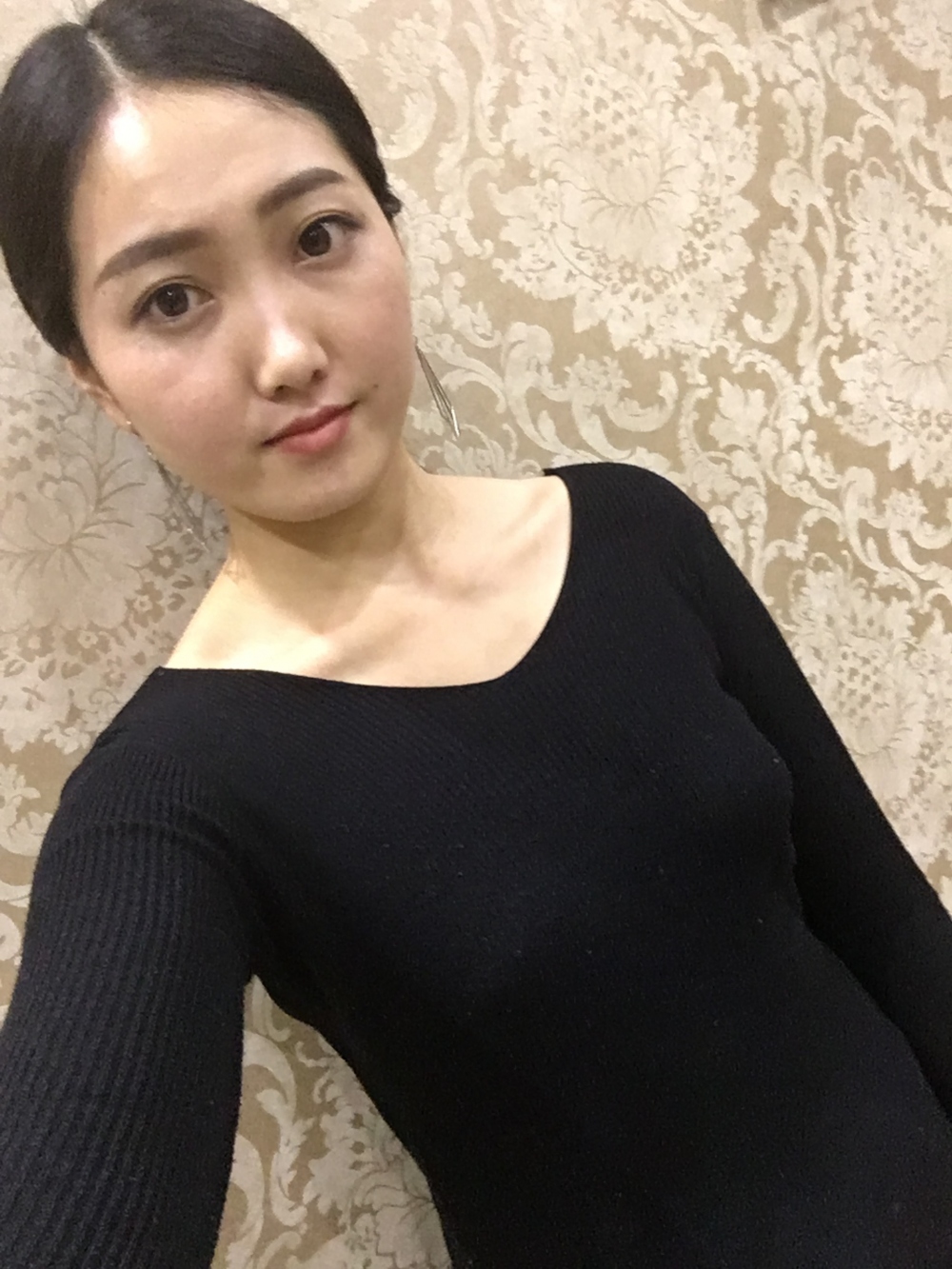 宜春美萊醫(yī)療整形醫(yī)生黃治林做自體脂肪隆胸怎么樣？附案例