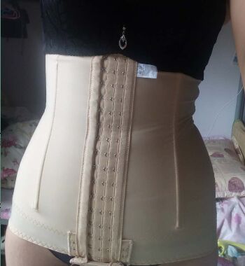 武漢東方麗人醫(yī)院整形美容科胡江偉醫(yī)生做腰腹吸脂案例效果對比圖