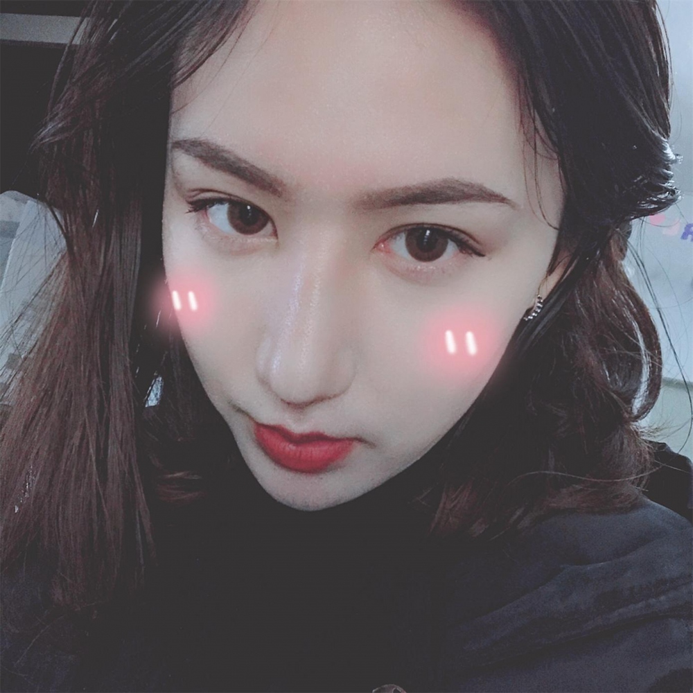 煙臺洛神醫(yī)學美容醫(yī)院張瑞允醫(yī)生做硅膠隆鼻怎么樣？附硅膠隆鼻案例