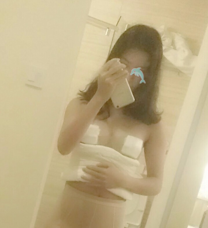 天津怡麗亞韓整形醫(yī)院林海峰醫(yī)生做自體脂肪隆胸真實(shí)案例效果對比圖 天津怡麗亞韓整形醫(yī)院林海峰醫(yī)生做自體脂肪隆胸真實(shí)案例效果對比圖