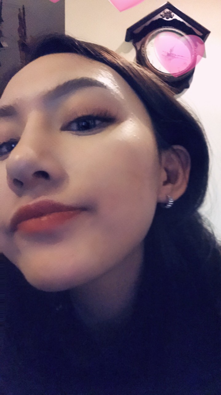 煙臺洛神醫(yī)學美容醫(yī)院張瑞允醫(yī)生做硅膠隆鼻怎么樣？附硅膠隆鼻案例