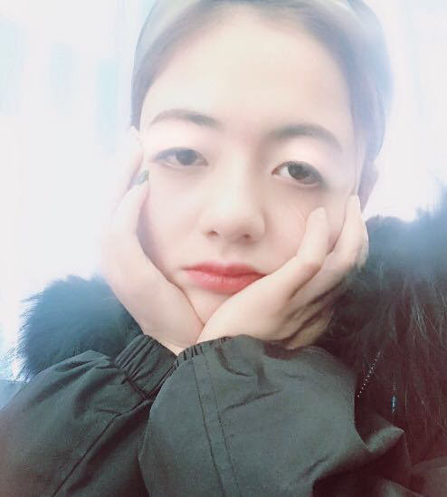 珠海平安康復(fù)醫(yī)院整形美容中心查元坤醫(yī)生面部吸脂案例效果對(duì)比圖