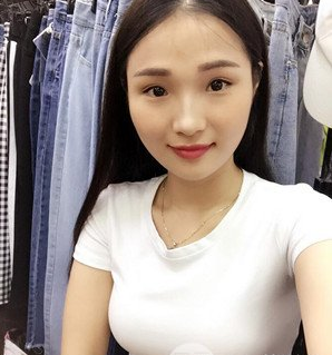 珠海萊茵醫(yī)療美容醫(yī)院崔俊溶醫(yī)生做自體脂肪隆胸效果怎么樣？附自體脂肪隆胸案例