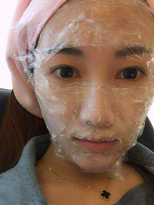 重慶五洲女子醫(yī)院整形美容中心做光子嫩膚怎么樣？淡明斌醫(yī)生光子嫩膚案例