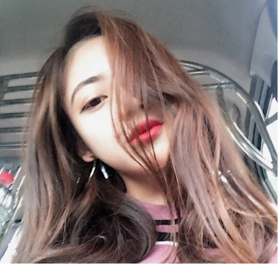 珠海平安康復(fù)醫(yī)院整形美容中心查元坤醫(yī)生面部吸脂案例效果對(duì)比圖