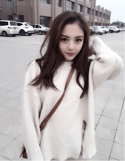 珠海平安康復(fù)醫(yī)院整形美容中心查元坤醫(yī)生面部吸脂案例效果對(duì)比圖