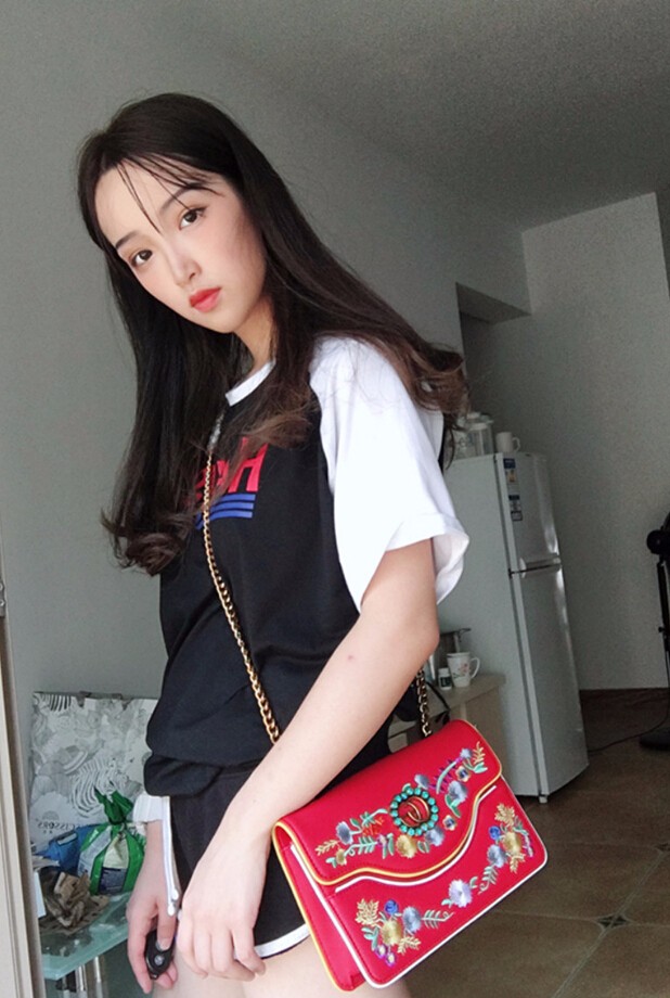 重慶威妮醫(yī)療整形醫(yī)生伊莉做切開(kāi)雙眼皮+開(kāi)眼角真人案例效果對(duì)比圖 重慶威妮醫(yī)療整形醫(yī)生伊莉做切開(kāi)雙眼皮+開(kāi)眼角真人案例效果對(duì)比圖