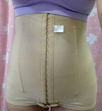 武漢東方麗人醫(yī)院整形美容科胡江偉醫(yī)生做腰腹吸脂案例效果對比圖