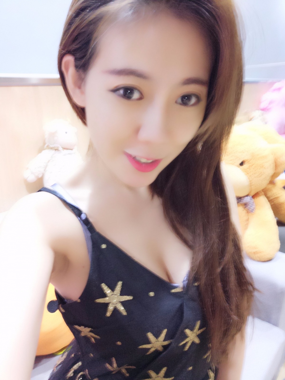 煙臺壹美整形醫(yī)院朱建瑩醫(yī)生做自體脂肪隆胸怎么樣？附自體脂肪隆胸案例