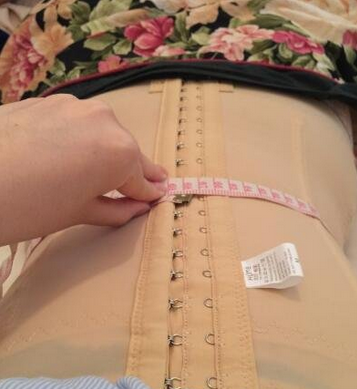 成都蜀尚蓉雅整形醫(yī)生張知華做腰腹吸脂效果怎么樣？附腰腹吸脂案例