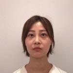 天津歐華威莎整形醫(yī)生姚玲做面部埋線提升效果怎么樣？附埋線提升案例