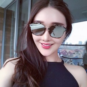 廣州柏德口腔蘭海龍醫(yī)生做瓷貼面效果怎么樣？廣州柏德口腔瓷貼面案例分享