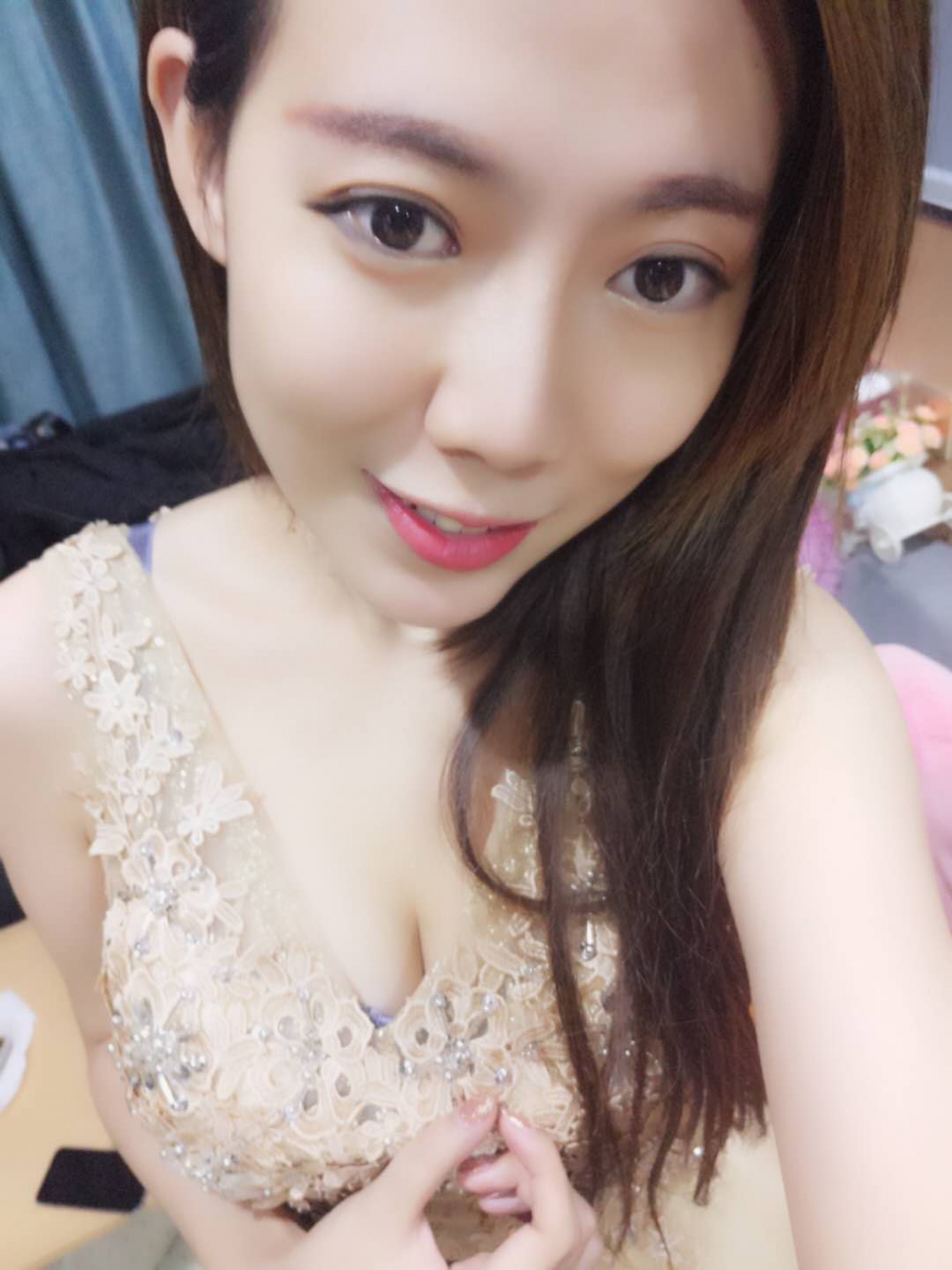 煙臺壹美整形醫(yī)院朱建瑩醫(yī)生做自體脂肪隆胸怎么樣？附自體脂肪隆胸案例