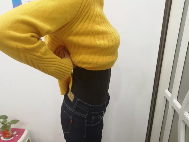 沈陽天使醫(yī)療整形醫(yī)生黃展翼做水動力腰腹吸脂技術怎么樣？附水動力腰腹吸脂案例