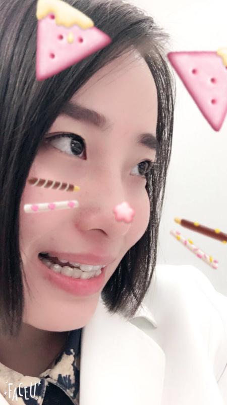 鄭州壹加壹整形醫(yī)院楊永利醫(yī)生做牙齒隱形矯正怎么樣？附牙齒隱形矯正案例