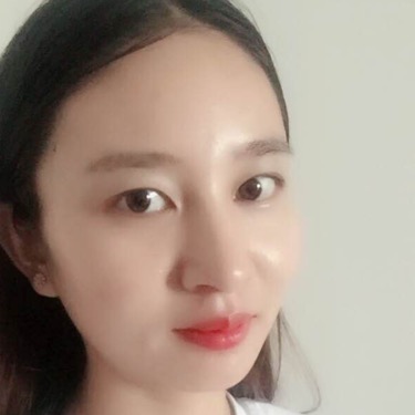 武漢維納斯整形醫(yī)院趙瑾醫(yī)生做玻尿酸墊下巴怎么樣？附玻尿酸墊下巴案例