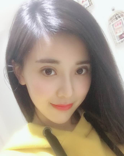 襄陽(yáng)維多利亞整形醫(yī)院安邰晥醫(yī)生做鼻綜合整形怎么樣？附鼻綜合整形案例