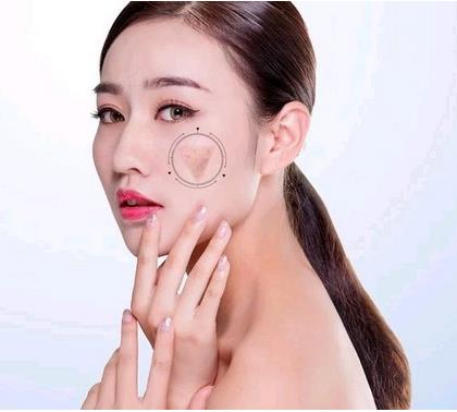 ?？诩t妝尚整形光子嫩膚