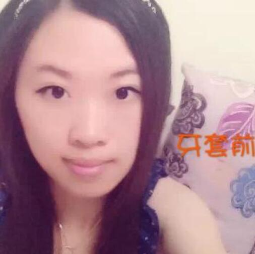 重慶嘉悅口腔醫(yī)院周繼祥醫(yī)生做金屬托槽矯正效果怎么樣？附案例效果對比圖