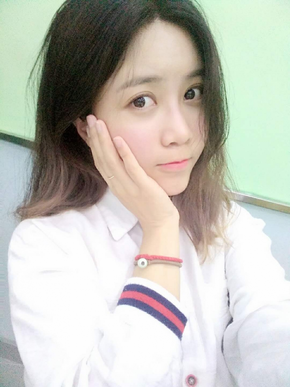 重慶美圣美邦整形醫(yī)院劉力維醫(yī)生做自體脂肪全臉填充案例效果對比圖