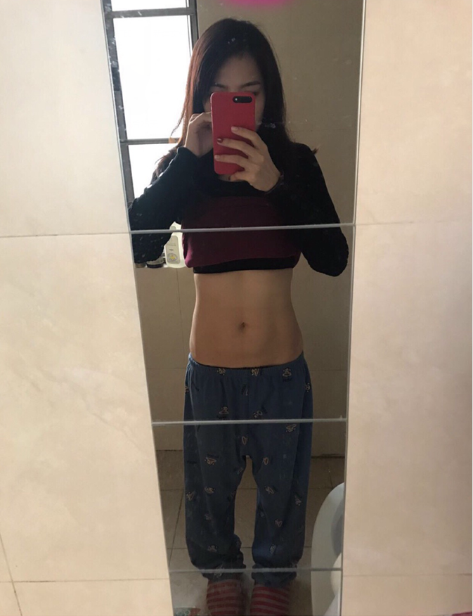 沈陽(yáng)天使醫(yī)療整形醫(yī)生黃展翼做水動(dòng)力腰腹吸脂技術(shù)怎么樣？附水動(dòng)力腰腹吸脂案例