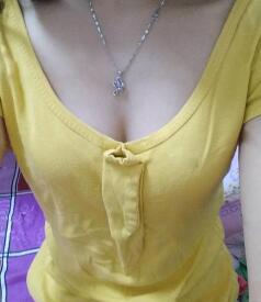 慈溪悅爾整形醫(yī)院趙天宇做自體脂肪隆胸怎么樣？附自體脂肪隆胸案例