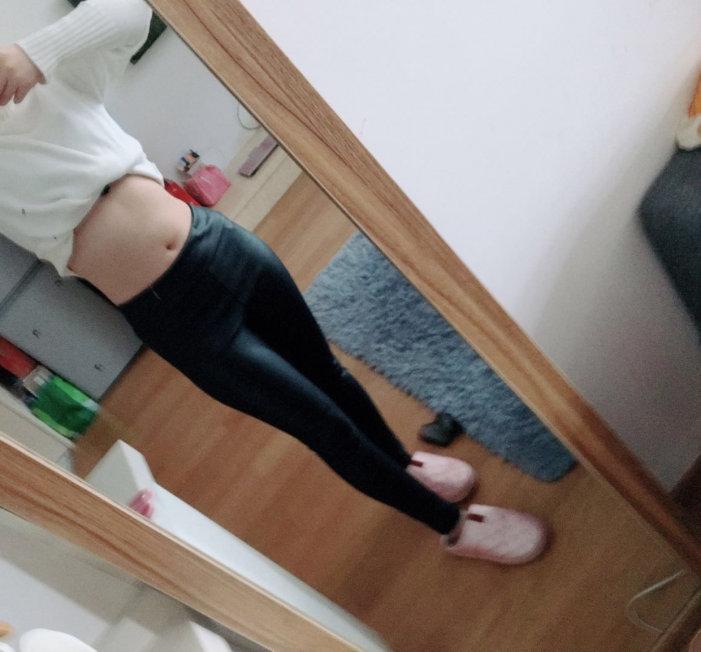 肇慶華美整形醫(yī)院陳巍醫(yī)生做腰腹吸脂效果怎么樣？附腰腹吸脂案例