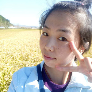 珠海蒂伊醫(yī)療整形醫(yī)生廖俊凱做激光祛斑效果怎么樣？附激光祛斑案例效果圖