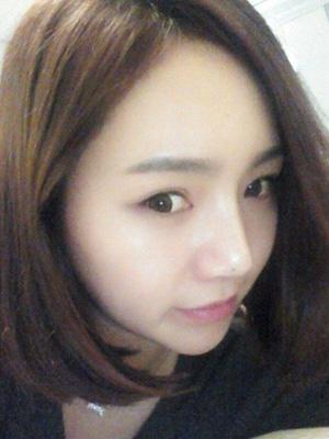 長(zhǎng)春中妍整形醫(yī)院吳學(xué)軍醫(yī)生做玻尿酸墊下巴+玻尿酸豐太陽(yáng)穴案例效果對(duì)比圖