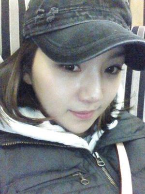 長(zhǎng)春中妍整形醫(yī)院吳學(xué)軍醫(yī)生做玻尿酸墊下巴+玻尿酸豐太陽(yáng)穴案例效果對(duì)比圖