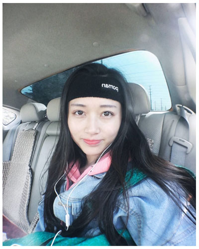 義烏傅氏口腔醫(yī)生朱雨晴做牙齒隱形矯正效果怎么樣？附牙齒隱形矯正案例