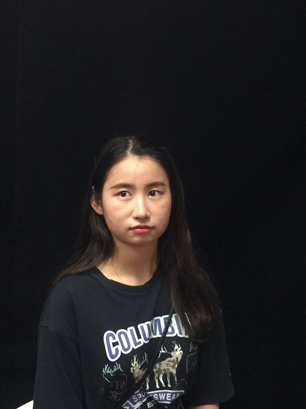 西安高一生整形醫(yī)院何志洪做埋線提升效果怎么樣？附埋線提升案例