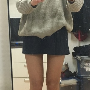 株洲雅美醫(yī)療整形醫(yī)生車旺做大腿吸脂效果怎么樣？附案例效果對比圖