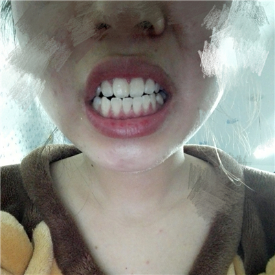 1518142532558101.jpg 1518142532558101.jpg