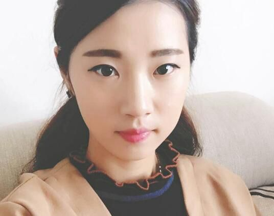 北京亞奧整形醫(yī)生程金龍做韓式三點雙眼皮+開內(nèi)眼角效果怎么樣？