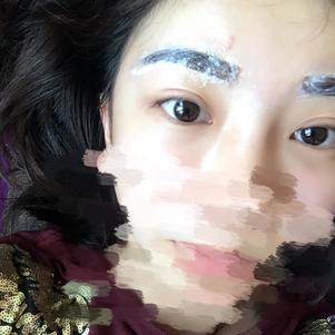 大同清木整形醫(yī)院張樹霞醫(yī)生做半永久紋眉效果如何？附半永久紋眉效果圖