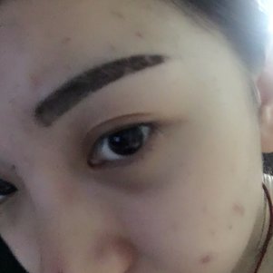 大同清木整形醫(yī)院張樹霞醫(yī)生做半永久紋眉效果如何？附半永久紋眉效果圖