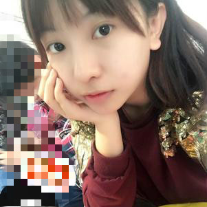 大同清木整形醫(yī)院張樹霞醫(yī)生做半永久紋眉效果如何？附半永久紋眉效果圖