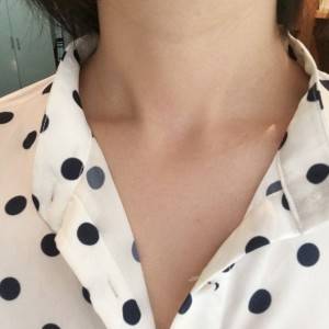 上海名媛醫(yī)療整形醫(yī)生閆嬌君做嗨體去頸紋效果怎么樣？附案例效果圖