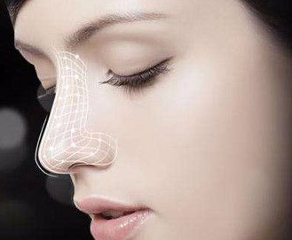 襄陽(yáng)韓美整形醫(yī)院鼻翼縮小