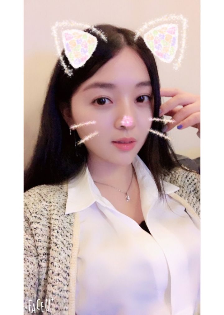 北京京韓整形醫(yī)生王義山做埋線雙眼皮怎么樣？附案例效果對(duì)比圖