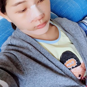 北京京民醫(yī)院整形外科醫(yī)生李鴻儒做硅膠隆鼻怎么樣？附案例效果圖