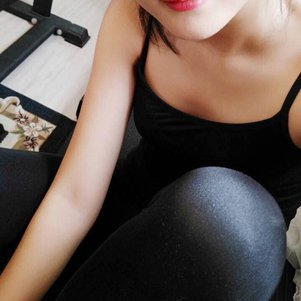 岳陽(yáng)愛(ài)思特醫(yī)療美容醫(yī)院醫(yī)生王福生做手臂吸脂怎么樣？附案例效果圖