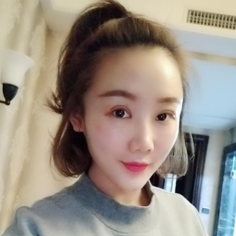 上海首爾麗格整形醫(yī)院醫(yī)生唐鏖做眼綜合+自體脂肪全臉填充案例效果對比圖