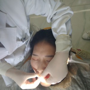 洛陽友好口腔醫(yī)院醫(yī)生李新然做牙貼面怎么樣？附案例效果圖