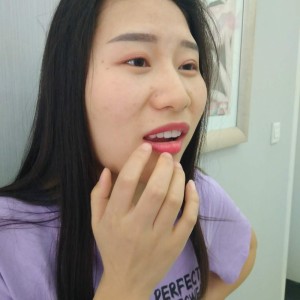 洛陽友好口腔醫(yī)院醫(yī)生李新然做牙貼面怎么樣？附案例效果圖
