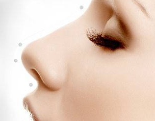 益陽韓美整形耳軟骨墊鼻尖