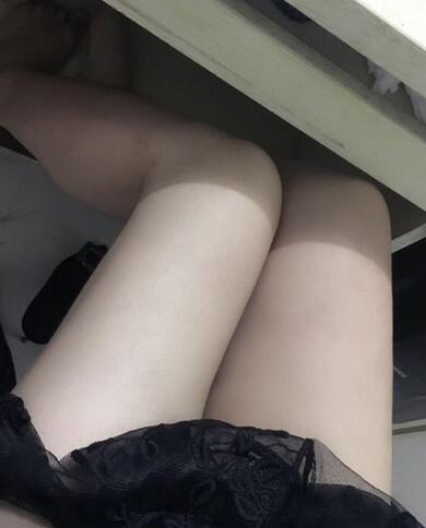 上海保加醫(yī)療美容門診部做大腿吸脂怎么樣？附楊勇醫(yī)生案例效果對比圖