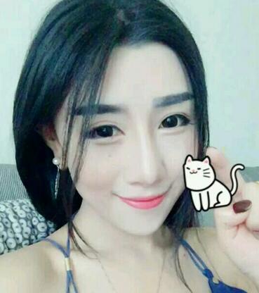 貴陽(yáng)泰康樂(lè)醫(yī)院整形美容科醫(yī)生陳璐做自體脂肪全臉填充效果怎么樣？