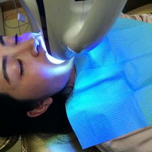 上?？仆呖谇会t(yī)院醫(yī)生鄧建儒做牙齒冷光美白怎么樣？附案例效果對比圖